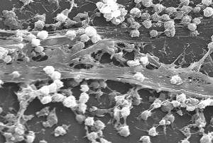 Staphylococcus aureus biofilm 01 Licensed under パブリック・ドメイン via ウィキメディア・コモンズ.